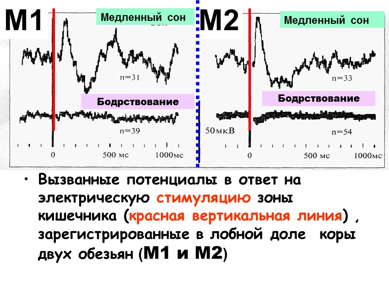 Вызванные потенциалы в ответ на электрическую стимуляцию зоны кишечника (красная вертикальная линия) , зарегистрированные
